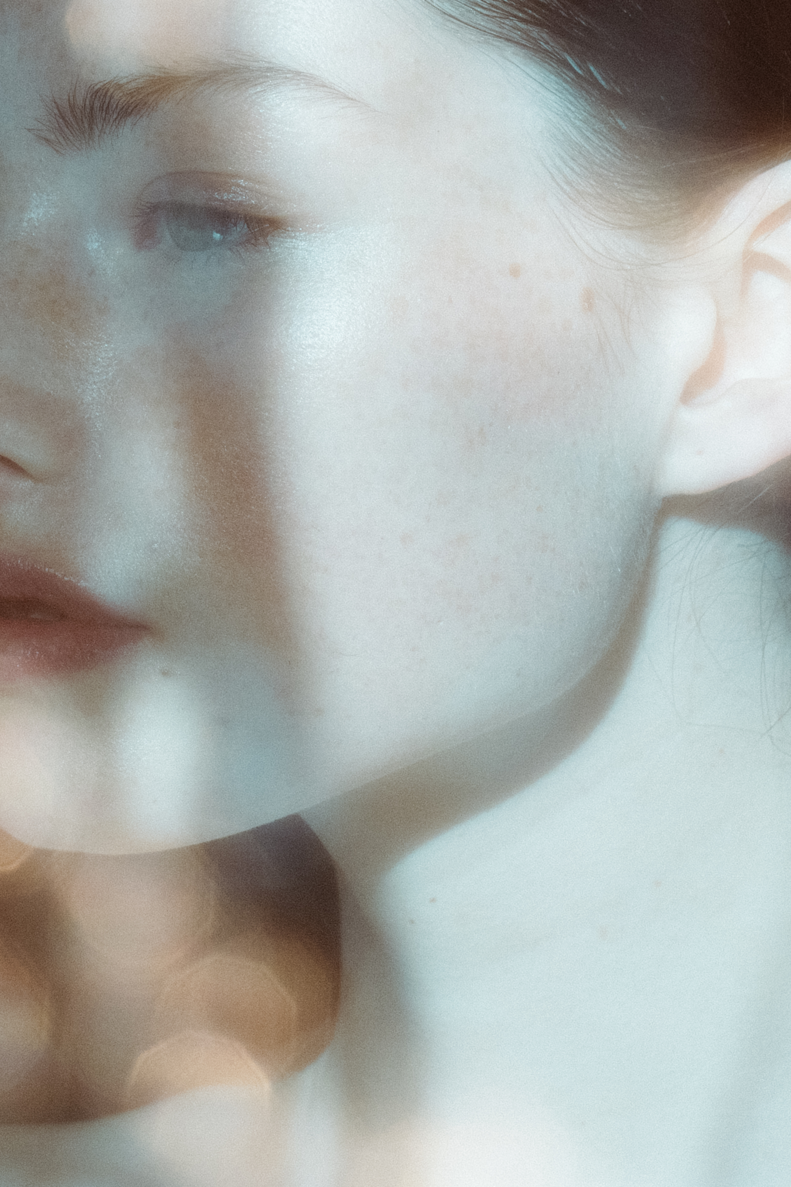 MIST